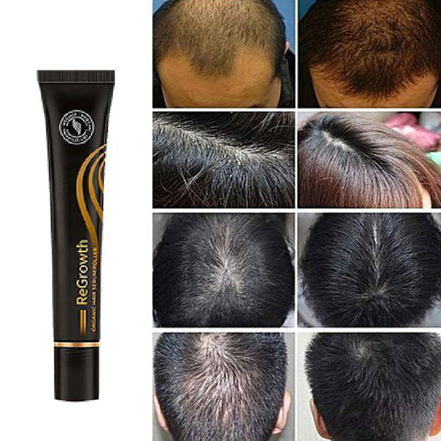 Repair Hair® | Hair Growth Oil - Reduces Hair Loss by 95% and Boosts Growth