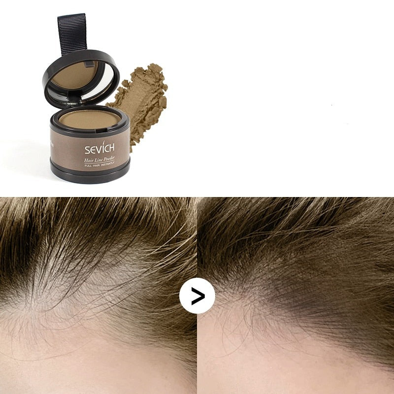 Waterproof Hair Concealer for Baldness and Gray Hair - Sevích