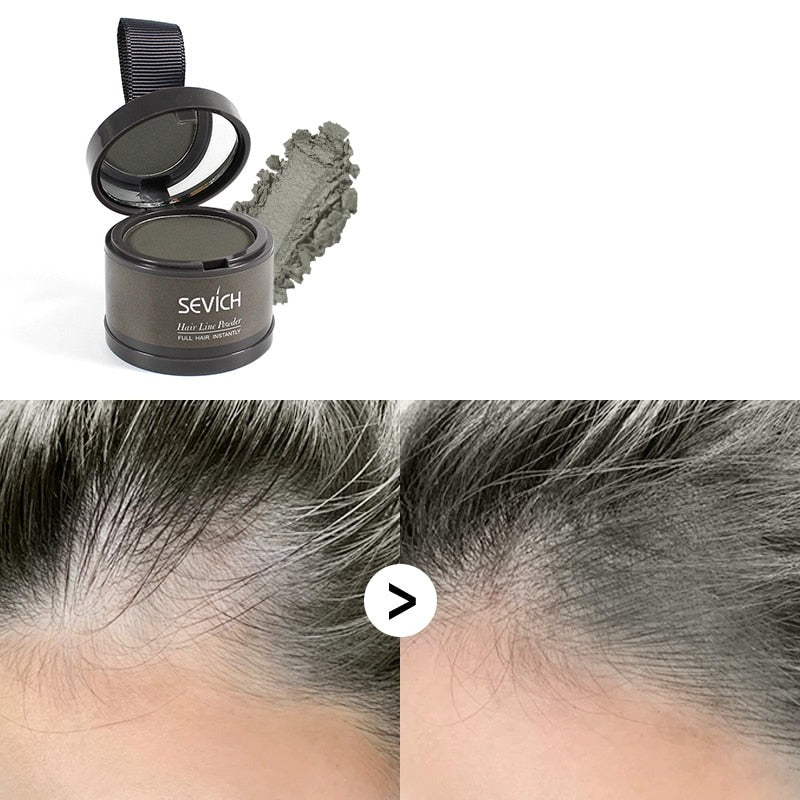 Waterproof Hair Concealer for Baldness and Gray Hair - Sevích