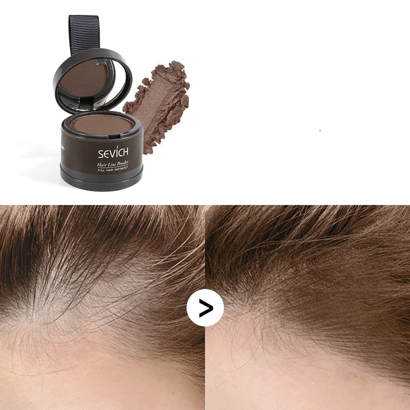 Waterproof Hair Concealer for Baldness and Gray Hair - Sevích